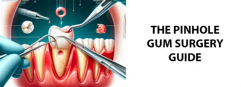 The Pinhole Gum Surgery Guide: Advantages and Disadvantages .